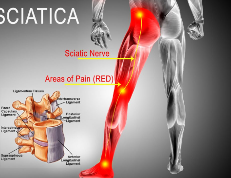 best office chair for sciatic pain